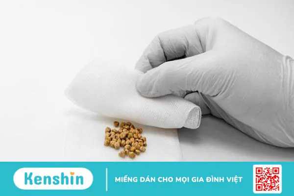 Viêm túi mật do sỏi: Căn bệnh nguy hiểm, có thể gây tử vong 1