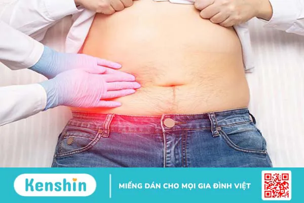 Viêm túi mật do sỏi: Căn bệnh nguy hiểm, có thể gây tử vong 2