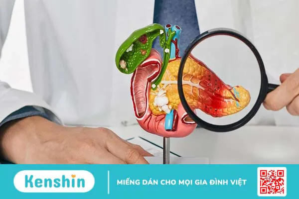 Viêm tụy hoại tử có nguy hiểm không?