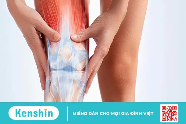 Viên uống Khớp Phong – Bí quyết phòng ngừa hiệu quả các bệnh lý về xương khớp