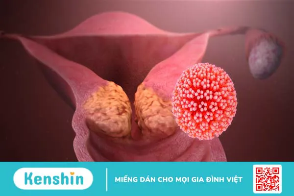 Virus HPV 31, 33, 35 gây nên những bệnh gì?