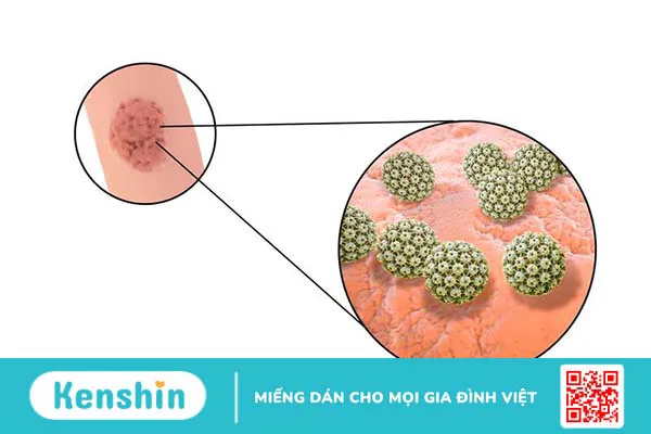 Virus HPV ở nam giới: Tầm soát và phòng ngừa