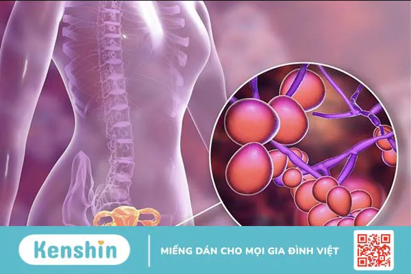 Virus HPV type 16 gây bệnh gì? Phòng ngừa như thế nào?