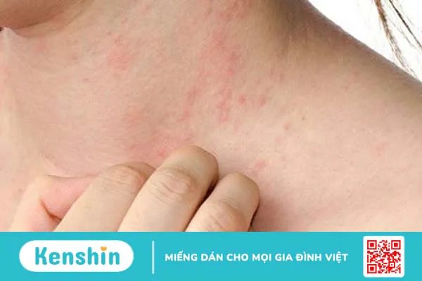 Vô niệu: Tình trạng nhiều người mắc phải hiện nay 3