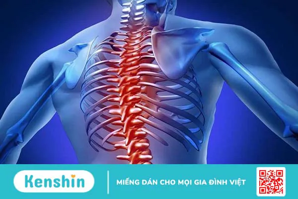 Vôi hóa cột sống có chữa được không? Biện pháp phòng ngừa và cách điều trị bệnh hiệu quả