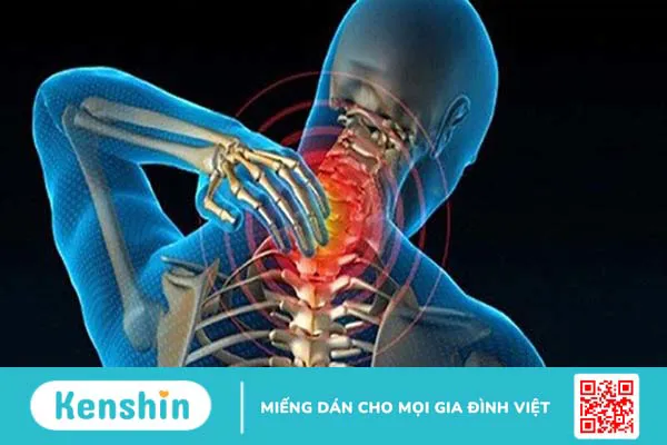 Vôi hóa cột sống có chữa được không? Biện pháp phòng ngừa và cách điều trị bệnh hiệu quả 1