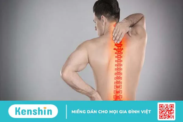 Vôi hóa cột sống có chữa được không? Biện pháp phòng ngừa và cách điều trị bệnh hiệu quả 3