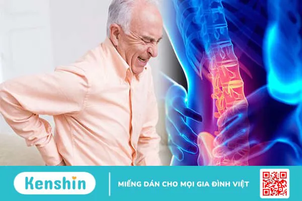 Vôi hóa cột sống thắt lưng: Nguyên nhân, triệu chứng và cách điều trị hiệu quả