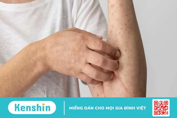 Wax lông có làm lông mọc nhiều hơn không? Một số lưu ý trước khi wax lông