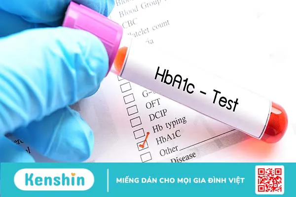 Xét nghiệm A1c là gì? Ý nghĩa của HbA1c trong việc kiểm soát đường huyết