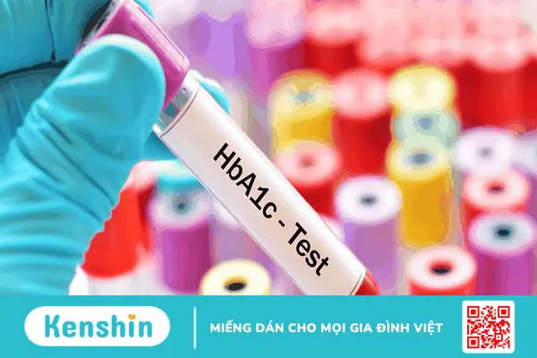 Xét nghiệm A1c là gì? Ý nghĩa của HbA1c trong việc kiểm soát đường huyết