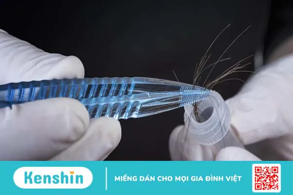 Xét nghiệm ADN bằng tóc và những điều bạn cần biết