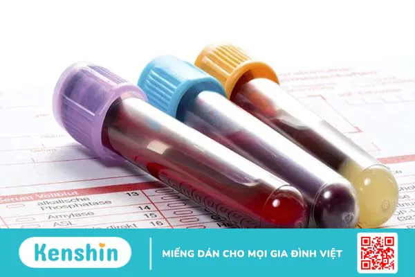 Xét nghiệm bạch cầu trong chẩn đoán bệnh