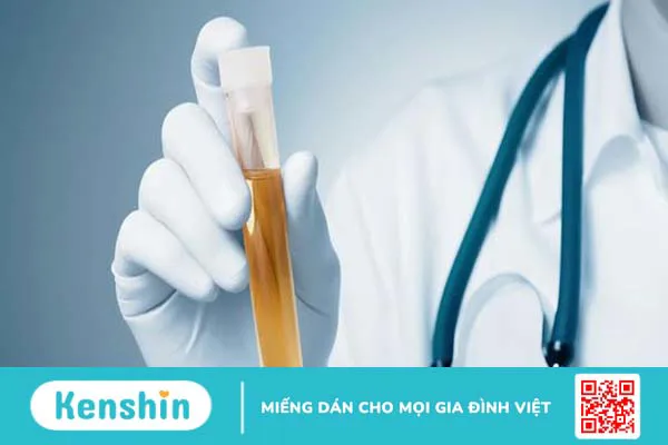 Xét nghiệm cặn addis: Phương pháp chẩn đoán hội chứng thận hư hiệu quả