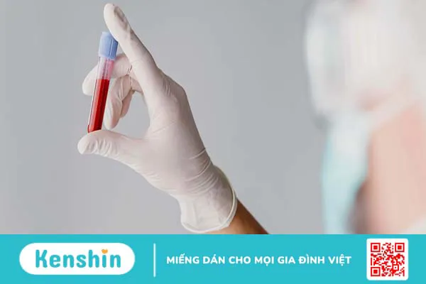 Xét nghiệm chất đánh dấu trong luân chuyển xương