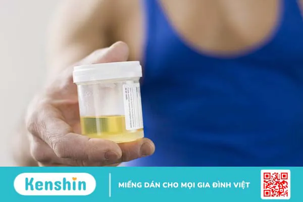 Xét nghiệm chất đánh dấu trong luân chuyển xương 4