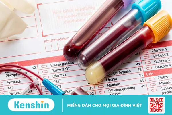 Xét nghiệm công thức máu toàn bộ bao gồm những gì?