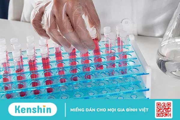 Xét nghiệm Cytochrome P450 là gì? Những thông tin cần biết 2