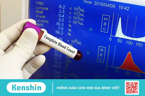 Xét nghiệm đếm tế bào máu là gì? Có mấy cách đếm tế bào máu?