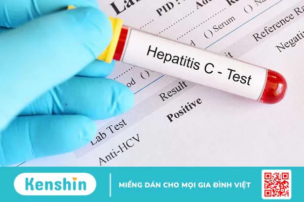 Xét nghiệm HCV Ab là gì? Vai trò của HCV Ab trong chẩn đoán bệnh viêm gan 3