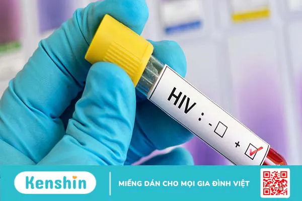 Xét nghiệm HIV ở đâu TPHCM? Thời điểm nào nên thực hiện xét nghiệm?