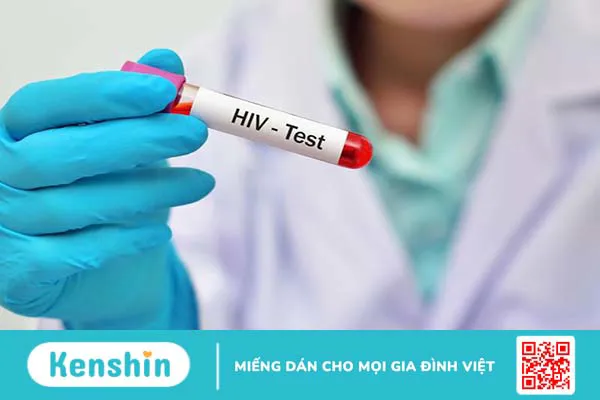 Xét nghiệm HIV ở đâu TPHCM? Thời điểm nào nên thực hiện xét nghiệm?