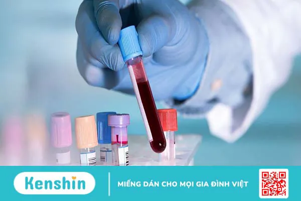 Xét nghiệm máu có phát hiện HPV không? Các phương pháp cận lâm sàng HPV phổ biến