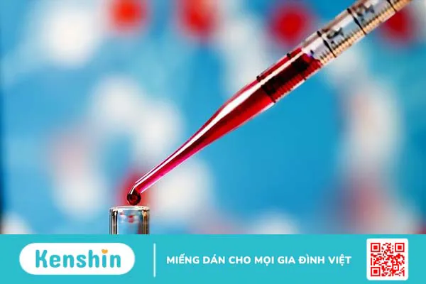 Xét nghiệm máu có phát hiện HPV không? Các phương pháp cận lâm sàng HPV phổ biến