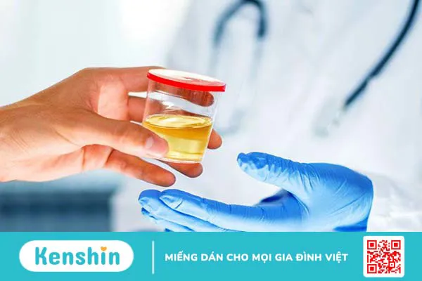 Xét nghiệm Microalbumin niệu phát hiện được những bệnh gì? 01