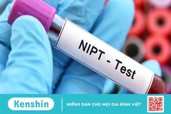 Xét nghiệm NIPT ở đâu? Bạn đã biết chưa?