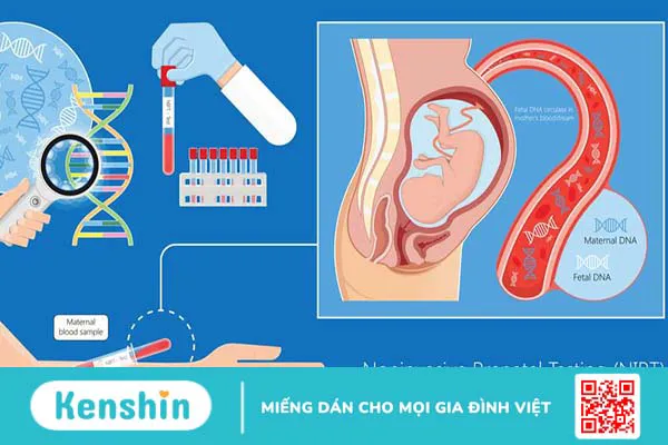 Xét nghiệm NIPT ở đâu Hà Nội uy tín, chất lượng nhất?