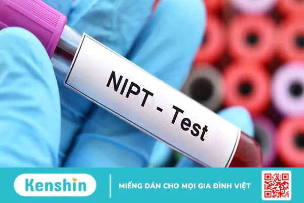 Xét nghiệm NIPT phát hiện những bệnh gì?