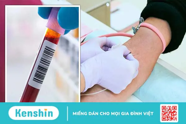 Xét nghiệm osteocalcin và bệnh loãng xương 3