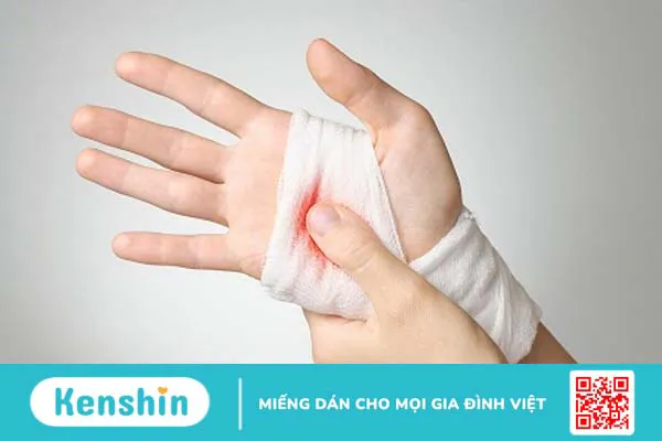 Xét nghiệm sinh sợi huyết trong đánh giá khả năng đông và cầm máu