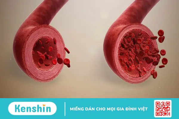 Xét nghiệm sinh sợi huyết trong đánh giá khả năng đông và cầm máu