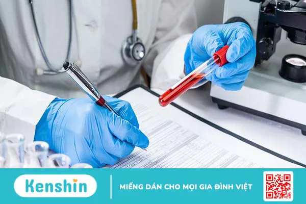 Xét nghiệm sinh sợi huyết trong đánh giá khả năng đông và cầm máu