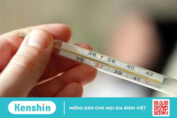 Xét nghiệm sốt xuất huyết có cần nhịn ăn không? Bệnh nhân cần lưu ý gì?