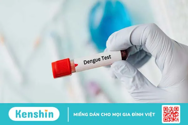 Xét nghiệm sốt xuất huyết có cần nhịn ăn không? Bệnh nhân cần lưu ý gì?