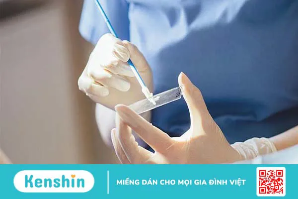 Xét nghiệm tế bào học là gì? Các loại xét nghiệm tế bào học