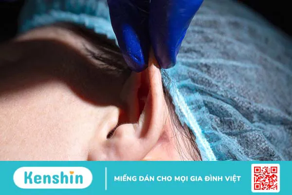 Xét nghiệm thời gian máu chảy: Vai trò và đối tượng cần thực hiện