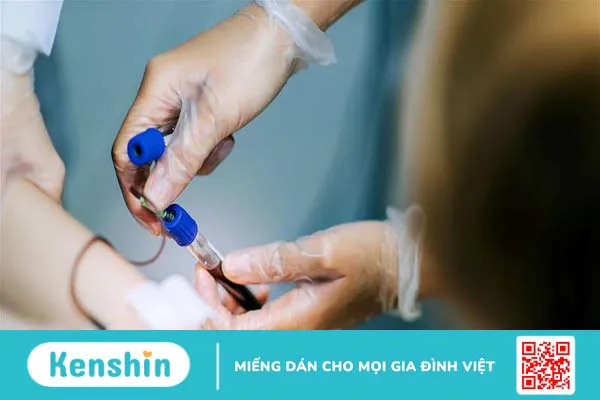 Xét nghiệm thời gian máu chảy: Vai trò và đối tượng cần thực hiện