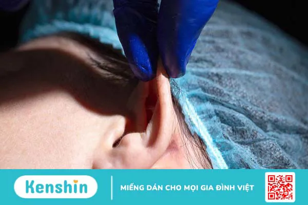 Xét nghiệm thời gian máu chảy: Vai trò và đối tượng cần thực hiện