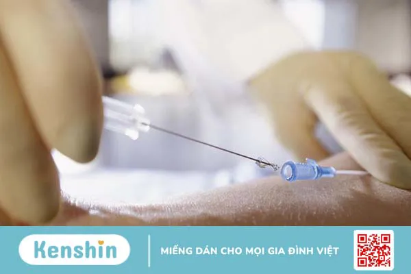 Xét nghiệm thời gian máu chảy: Vai trò và đối tượng cần thực hiện