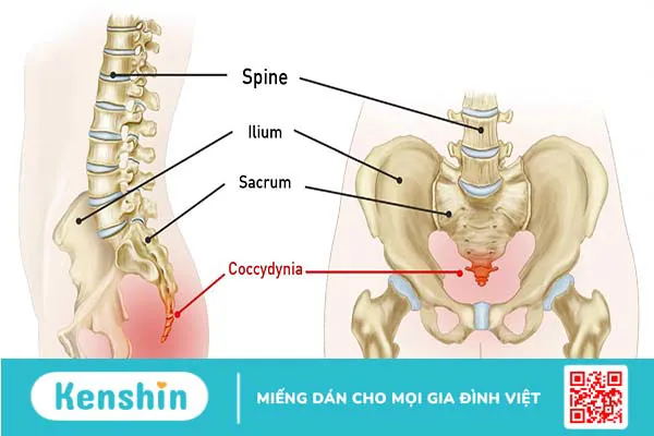 Xương cụt nằm ở đâu và có vai trò gì? Thông tin về bệnh lý tại xương cụt