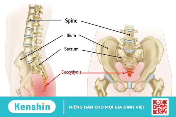 Xương cụt nằm ở đâu và có vai trò gì? Thông tin về bệnh lý tại xương cụt