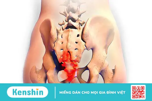 Xương cụt nằm ở đâu và có vai trò gì? Thông tin về bệnh lý tại xương cụt