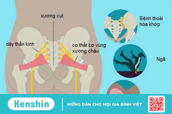 Xương cụt nằm ở đâu và có vai trò gì? Thông tin về bệnh lý tại xương cụt