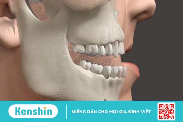 Xương hàm: Cấu tạo, chức năng và một số bệnh lý liên quan