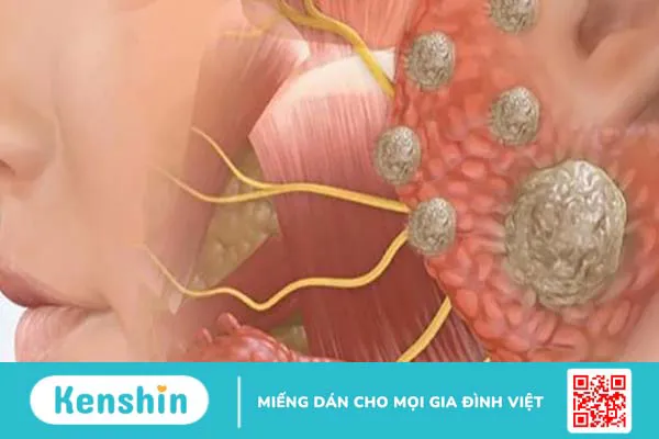 Xương hàm: Cấu tạo, chức năng và một số bệnh lý liên quan 4