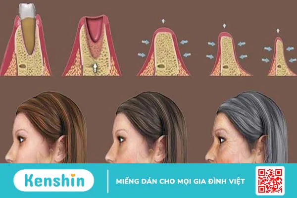 Xương hàm: Cấu tạo, chức năng và một số bệnh lý liên quan 5